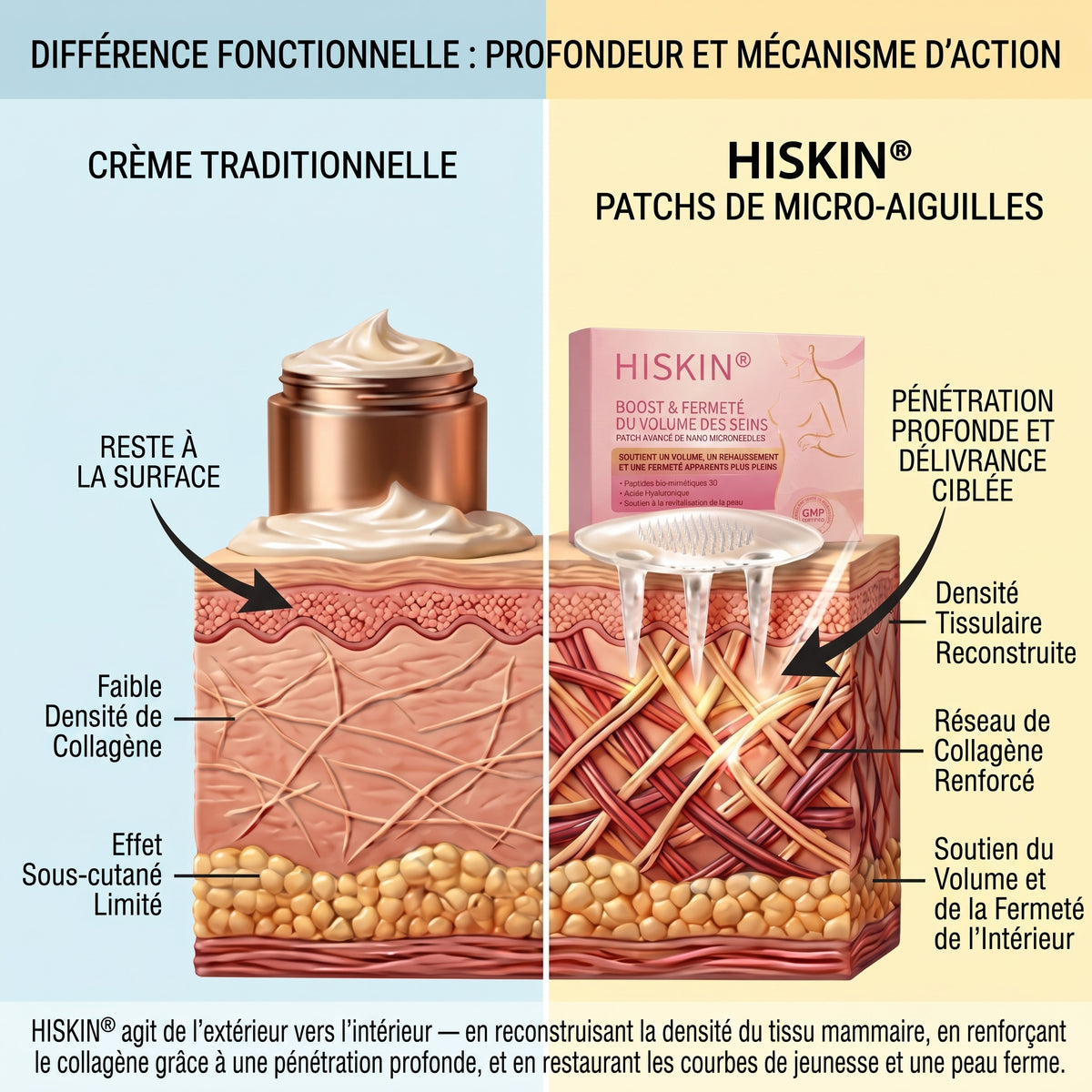 HISKIN® 👩‍⚕️ Patch Ciblé Avancé à Nano Micro-Aiguilles pour le Rehaussement de la Poitrine