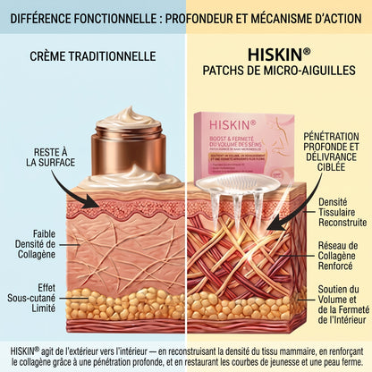 HISKIN® 👩‍⚕️ Patch Ciblé Avancé à Nano Micro-Aiguilles pour le Rehaussement de la Poitrine